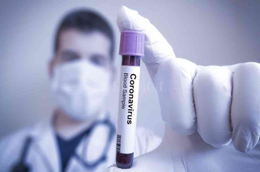 EL CORONAVIRUS EN LOS LABORATORIOS